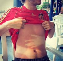 Боюсь представить обстоятельства, при которых получен такой загар