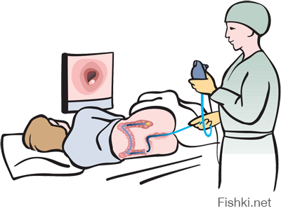 Анекдот... Афтар, ты либо 3.14здишь как Лёва Троцкий, либо ПЕРЕСКАЗЫВАЕШЬ. Почему? Извольте:

ГАСТРОСКОПи́Я (от др.-греч. γαστήρ — «желудок» и σκοπέω — «наблюдаю, смотрю»); другое название эзофагогастродуоденоскопия, ЭГДС — одна из разновидностей эндоскопического обследования — осмотр пищевода, полости желудка и двенадцатиперстной кишки при помощи специального инструмента — гастроскопа, вводимого в желудок через рот и пищевод.


или все-таки:

Колоноскопи́я — это диагностическая медицинская процедура, во время которой врач-эндоскопист осматривает и оценивает состояние внутренней поверхности толстой кишки при помощи специального зонда.

Неувязочка однако )))