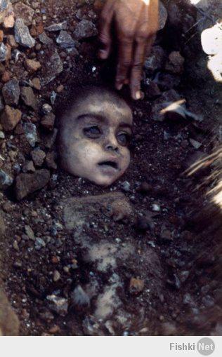 Декабрь 1984 года. Бопа, Индия.
Ребенок, погибший в результате утечки ядовитого газа при аварии на химическом заводе "Юнион Карбайд" (Union Carbide).