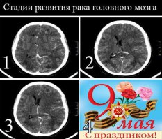 Детские утренники, посвящённые 70-летию Победы (21 фото)