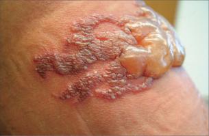 Между прочим, у людей бывает аллергия на хну. И на фига людям с такими проблеммам со здоровьем ещё и такое: