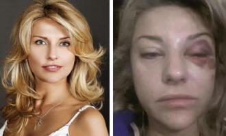 Умылась после свидания и получила природный макияж)