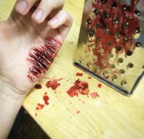 Когда в России появились афигенно ультрамодные, суперострые овощерезки Бош, ко мне в поликлинику вот такие вот очереди, как в мавзолей устраивали! Как правило в платочке пол большого пальца приносили пришить... и пришивал =)