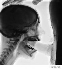 Прозрачная скорлупа показала, как растет эмбрион