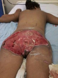 Резать, резать к чертовой матери!!!

Это ж как надо себя не любить, что бы с самим собой, такое сотворить!