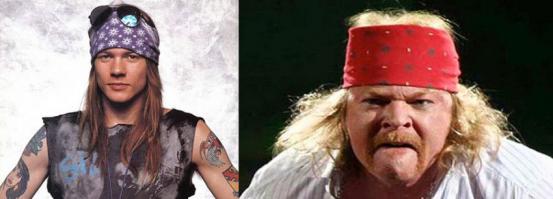 Знаменитости: до и после пластических операций