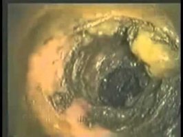 Вот так выглядит снятая при ремонте и замене труб водопроводная труба 