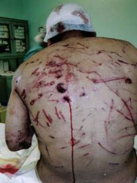 А то может закончиться так... Самое страшное на показываю