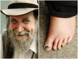 Судя по "сжатым" пальцам, эти ноги постоянно обуты, причем в довольно тесную обувь! Дополнительный вопрос: Почему ногти зелёные?