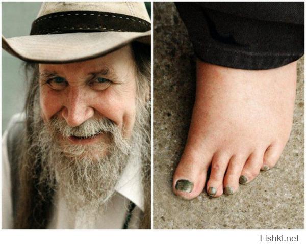 Судя по "сжатым" пальцам, эти ноги постоянно обуты, причем в довольно тесную обувь! Дополнительный вопрос: Почему ногти зелёные?