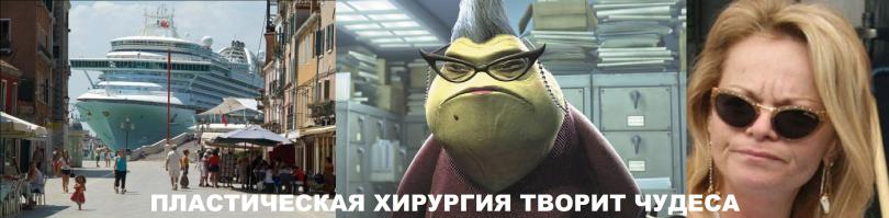 Знаменитости: до и после пластических операций