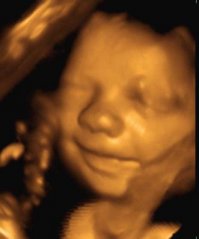 Решила погуглить "УЗИ при беременности", вот какие в основной своей массе были картинки )))

На первой ребенок повернулся спиной, на третьей - многоплодная беременность.

Кстати, со вторым ребенком когда были на УЗИ в 30 недель наржались - вначале он пил околоплодную жидкость (было видно как он двигал челюстями и глотательные движения), потом он так смачно зевнул (скажем так, потому что зевать они еще не умеют), потом начал делать какие-то фигуры пальцами - типа дули, почесал ногу и как-будто махал нам прямо в экран, а я чувствовала как он гладит меня изнутри. Потом было видно как напрягся член (даже врач удивился размерам - говорит: "Это он пописал") и тихонько улегся. И все это за 5 минут. Потом когда малый родился проявились все эти качества -  он очень любит гладить меня: по спине,, по руке при этом заискивающе смотрит в глаза; водохлеб, когда нервничает, то чешет ногу и любит играть на публику.