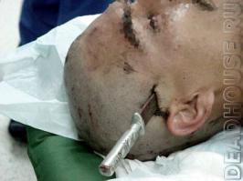 Легкий способ получить рану