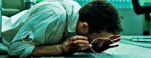 Заключенный в США избил себя и подал жалобу на детективов