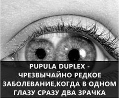 Объясните по подробнее: Два зрачка в одном глазе, и оба действующие??? Если оба видят, значит обзор зрения у такого человека потрясный, плюс если один ослепнет останется второй глаз, а значит это не болезнь?