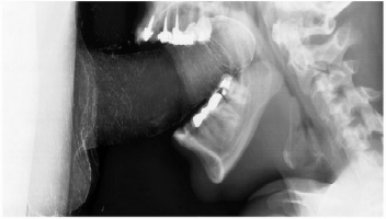 Один день в жизни женского рта