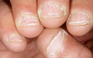 Это всё уравновешивается любителями погрызть ногти