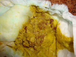 ну держи картинку...