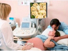 Фотоподборка за 21.01.2015