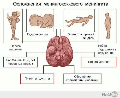 Информация, полученная putnik1, подтверждается.

Да, действительно, обеспеченность менингококковой вакциной не больше 14%.
Да, эпидемиологи и инфекционисты получили запрет на "распространение панических настроений".

Приказано оформлять смерти не как смерть от менингита и разрешено признавать только в исключительных случаях. Поскольку министерство (здравоохранения) и государство (Украина) не располагают средствами, а "прикрыть Киев невозможно". Поэтому "нельзя подрывать веру людей в себя".

К моменту смерти 15-летней девочки (кстати, карантин в ее учебном заведении, хотя кроме нее инфекция выявлена еще у четырех учащихся и преподавателя, так и не был объявлен) она была восьмой, умершей от менингококковой инфекции, сейчас реально (на позавчерашний день) - 17 киевлян, умерших от менингококковой инфекции.

Я очень благодарен дорогой Варяг-2007 за обстоятельную проверку этих сообщений.
Не стану скрывать, до сих пор у меня были сомнения.
Ибо даже по нынешним временам это уже перебор.
Теперь, зная, у кого наведены справки, сомнений нет.
( Collapse )

И тот факт, что врачи, ответственные за контроль над эпидемиологической обстановкой в Майданеке, сейчас отправляют детей и внуков куда угодно, хоть в деревню, хоть в Россию, лишь бы не оставлять их в зараженном городе, говорит очень о многом. Подтверждая, что (цитата из личного письма) "Не уверена, что эпидемии можно избежать. С менингитом у нас всегда была проблема, еще при Кучме, в прошлом году речь шла даже о вспышке, но тогда принимались меры, а сейчас нужно самой думать о семье".

Если честно, злорадствовать не хочу, да и не могу.
Наоборот, "думая о грядущей судьбе Майданека, я, как гуманист, содрогаюсь".
И еще раз повторяю: "Так что, наткнувшись в моем блоге на что-нибудь, во что не хочется и не можется верить, не спешите негодующе морщить носики. Просто ждите..."