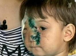 все любители бойцовых собак, к вам обращаюсь, вы меня щас заминусите, но мне плевать. Ессно вы считаете что ваша собака няшка и любит детей и кошечек как и вы, но это непредсказуемая тварь, в любую секунду могущая напасть на человека и серьезно его покалечить. Я когда вижу питбуля и ему подобных на улице, стараюсь обходить подальше. Их место в питомниках, да, мля, их в армии только держать надо или в полиции