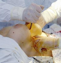 Оптимизация и рестайлинг души