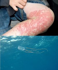 А вот и самый опасный австралийский подводный обитатель:
так просто не поныряешь...