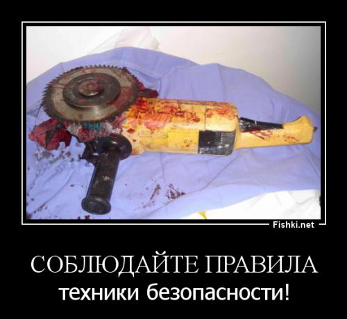 Мастера своего дела. Хирурги пришили оторванную руку