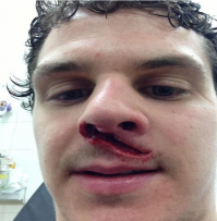 А шайбой по е6(алу) каково?
Или (на фото) коньком по оному?