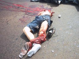 Дааа повезло ему! выжил что бы была еще одна попытка угробить людей вокруг из-за своего здоровья  ему надо мотоцикл купить, там все проще было бы ))))) Вообще я не понимаю почему ущербным дают водительские права, они ведь губят людей вокруг