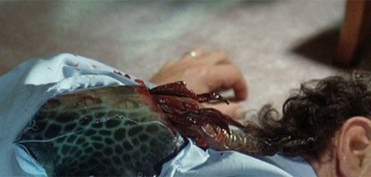 Да у Обамки, тьфу с большой буквы написал, на спине давно вот такое сидит...