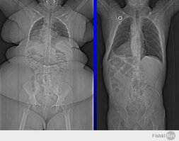 девкам респект 
широкая кость