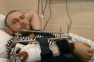 При наличии определенных навыков работы с пропагандистским материалом, который поставляет зомби-потребителям официальная идеологическая машина, можно составить достаточно точную картину происходящего в зоне АТО. 

Надо лишь знать, как декодировать получаемую информацию. Итак, если ведущая «плюсов» Алла Мазур надела черные колготки, значит началось отступление ВСУ из Дебальцево. Это все знают. Поговорим о других «маркерах», которые позволяют делать правильные выводы. Прежде всего, надо следить за «полевыми командирами». Если «Семен Семенченко» говорит, что ситуация в Дебальцево находится под контролем украинских войск, значит полный песец. Так было под Иловайском (зашли в город с четырех сторон и полностью его «контролируем»), так было с донецким аэропортом («наши ребята удерживают третий этаж и полностью контролируют все близлежащее пространство»). Теперь Дебальцево. 

В случае захлопывания котла самый верный «маркер» – ранение «Семена Семенченко» в ж…пу с последующим получением от командования очередного ордена. Правда, на этот раз первым почувствовал неладное лидер ДУК ПС («правосеки» нынче так себя именуют) Дмитрий Ярош. Он опередил «Семенченко», получив тяжелейшее ранение. По официальной версии, машину Яроша разнесло «Градом», он чудом выжил, получил незначительные повреждения, ему помазали лоб зеленкой, а первыми словами «героя» были: «Доктор, я автомат держать смогу?». В этом месте все расово правильные патриоты плачут, а затем бегут в палату к легендарному «правосеку» фоткаться на его фоне. На самом деле бухой водила авто Яроша с характерными номерами «ПТН ПНХ» не справился с управлением, перевернулся, и в результате Дима оказался со сломанной в двух местах рукой. Правой. Но согласитесь, что легенда гораздо круче. Особенно трогает, как «побратимы» рассказывали Ярошу анекдоты про Путина по дороге в морг, простите, в госпиталь, чтобы он не потерял сознание. 

Сознание Дима не потерял, но выходить из больнички явно не торопится. Видимо, находясь под действием успокоительных и других не менее интересных таблеток, он разработал довольно интересную интерпретацию популярной концепции «в Генштабе все предатели». Да, обратите внимание на данный «маркер». Как только в пабликах свидомых и на их персональных страницах начинается срач на тему «Генштаб всех слил», значит потери зашкаливают, войска отступают, а в первых рядах, естественно, находятся «добровольческие батальоны». После раненой задницы «Семена Семенченко» это второй по значимости признак. Но вернемся к «герою» со сломанной в двух местах рукой. Ярош выдвинул смелую и инновационную идею «гибридного Генштаба». Оказывается, примерно 93% членов Генерального штаба – предатели, двойные агенты, тыловые крысы, пузатый сброд. Примерно в такой последовательности. Оставшиеся семь процентов действительно толковые офицеры, с которыми он, Ярош, а также другие «полевые командиры» готовы сотрудничать и сформировать параллельный орган управления войсками. На мой взгляд, идея смелая и заслуживает всяческой поддержки. Параллельный Генштаб, параллельная вселенная и параллельная война – это то, что нужно. 

Идем дальше. Очередной признак полного песца ВСУ проявляется в резком повышении уровня героизма украинской армии и гигантских потерях «российских террористических войск». Классический пример – заявления депутата с бабьим лицом и визгливым голосом, смахивающего на беременную свиноматку, Антона Геращенко. Цитирую из последнего: «В результате точных артиллерийских ударов и смелых маневров наших танкистов враг был остановлен. Бои продолжаются на окраине Углегорска в сторону Енакиева. Там геройски держит оборону 13-й территориальный батальон ВСУ». 

Любому здравомыслящему человеку становится понятно, что в результате точных ударов после смелых маневров группировка АТО оказалась разгромленной. Что же касается потерь, то в особо критические дни в «Фейсбуке» уничтожается до одной дивизии ОСНАЗа ГРУ с перечислением номеров воинских частей, а в плен, как правило, берется два-три генерала МО РФ. Не больше. Конечно же, каждый час под точными ударами артиллерии ВСУ, сопровождаемыми необычайно смелыми, но, сука, крайне замысловатыми маневрами, террористы вынуждены отступать.

В Луганск и Донецк входят диверсионно-разведывательные группы. Это понятно. Единственное отличие от событий в Иловайске и ДАП – отсутствие традиционных трупов русских военных, на которых специализируется известная на Украине российская «правозащитница» Васильева. На этот раз глава СБУ Валентин Наливайченко усовершенствовал схему: оказывается, «террористы» подогнали аж четыре мобильных крематория и уничтожили все трупы. Он использовал старые наработки, поскольку Васильева постоянно прокалывалась, публикуя списки футбольных команд, которые она заживо «хоронила». Еще один, очень важный момент: когда катастрофа неизбежна, всех расово правильных патриотов начинает страшно интересовать цена на нефть марки «Брент» и курс рубля. Буквально все форумы за…тся темами «русня воет от обесценивания рубя», «нефтеориентированная экономика Рашки через два дня рухнет» и «санкции работают» (данная тема должна сопровождаться как минимум тремя веселыми смайликами). 

При этом полностью исчезает информация о курсе гривны, который на протяжении трех последних дней бьет «исторический минимум». Официальный – без нескольких копеек 16,15 гривен за бакс, неофициальный – 20-23 гривны за доллар. Подведем итоги по дешифровке новостей украинской пропаганды. Все маркеры (черные колготки Мазур, рука Яроша, смелые маневры ВСУ, тысячные потери «российско-террористических войск», нефть и курс рубля) четко указывают на образование Дебальцевского котла емкостью до десяти-двенадцати тысяч бойцов ВСУ. Информация абсолютно достоверная.