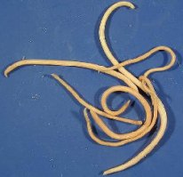 Одна фотография доказывающая почему не нужна:
шлисты...
ну у соседки у дочки пол лица нет..., но это мелочи уже...