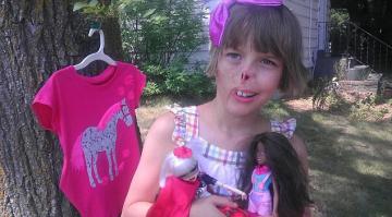 Одома́шнивание или иначе доместикация (от лат. domesticus — «домашний») — это процесс изменения диких животных или растений, при котором на протяжении МНОГИХ ПОКОЛЕНИЙ они содержатся человеком генетически изолированными от их дикой формы и подвергаются искусственному отбору.
Процесс одомашнивания диких животных начинается с искусственной селекции отдельных индивидов для получения потомства с определенными признаками, необходимыми человеку. Индивиды, как правило, выбираются в соответствии с определёнными желаемыми характеристиками, включая снижение агрессивности по отношению к человеку и представителям собственного вида. В этом отношении принято говорить об укрощении дикого вида. Целью одомашнивания является использование животного в сельском хозяйстве в качестве сельскохозяйственного животного или в качестве домашнего питомца. Если эта цель достигнута, можно говорить об одомашненном животном. Одомашнивание животного коренным образом изменяет условия для дальнейшего развития вида. Естественное эволюционное развитие заменяется искусственной селекцией по критериям разведения. Таким образом в рамках одомашнивания меняются генетические свойства вида.
Материаль взят из Википедии!
------------------
Так к чему я, еноты, лисы это все дикие животные, конечно можно взять маленького щенка и принести домой, но в могут со временем проявится дикие гены животных и потом не надо удивляться что еноты отгрызают члены, лица и так далее, случаев полно, если держите диких животных в доме, будьте осторожны и не оставляйте их один на один с детьми. Ниже на фото девочка который "милый" енот отгрыз нос.