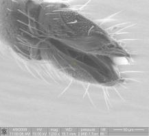 В своё время тоже нафоткал всякой ерунды:) И вот Вам, друзья мои, кончик хоботка комара, которым он нас кусает, при увеличении 1200х.