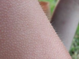 Что чувствуют глухие, когда первый раз в жизни начинают слышать?