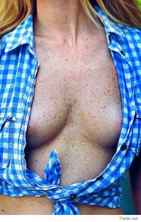 Девушки с веснушками 