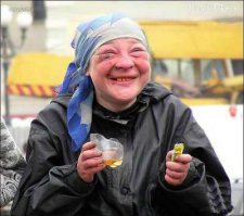 Корейская модель изуродовала себя инъекциями растительного масла 