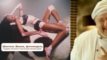 Звезды с дефектами внешности: уродство или изюминка?