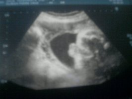 Мой сынуля. И да, на фото то, почему нас точно не спутали с девочкой)