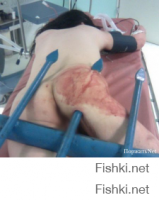 АФТОР ЗАКОНЧЕННЫЙ ДАЛПАЕПИНА