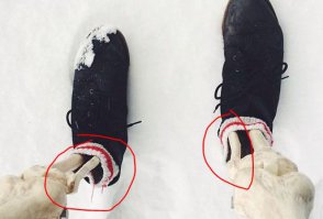 А почему у нее малоберцовая кость внутри? У обычных людей снаружи.