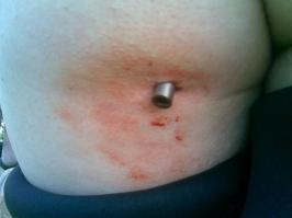 На счет пули в голове и заднице...