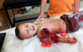 О них не расскажут ни CNN ни BBC Al-Jazira ORT RTR. Кровь мусульманских детей самая дешевая в мире.