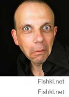 Ребенку вшили под кожу рога, чтобы удалить родимое пятно