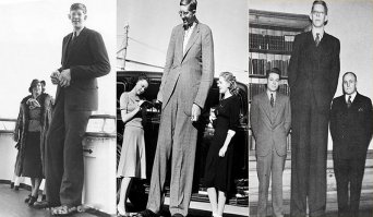 Гигантизм наверное. Скоро начнут суставы стираться, а если спортсмен то это крайне быстро произойдет.

Самым высоким мужчиной, о котором имеется достоверное свидетельство, был Роберт Першинг Уодлоу (Robert Pershing Wadlow, 1918 — 1940)