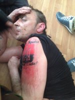 "Перед взятием в плен укр пытался кирпичом оттереть татуировку, чтобы слишком не палиться (так как фашики знают, что к ним совсем другое отношение, нежели к срочникам ВСУ), но печать нацизма не так уж просто оттереть."