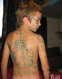 Папа лечит ветрянку