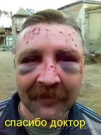 Как в Африке головную боль лечат 